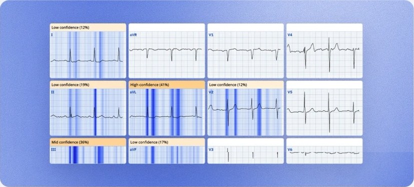 ECGxplain heatmaps