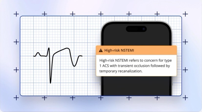 PMcardio flags a high-risk NSTEMI on an ECG