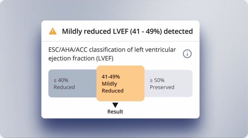 LVsense result card